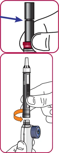 Medical illustration showing two steps: a hand pressing the top part of a device and a