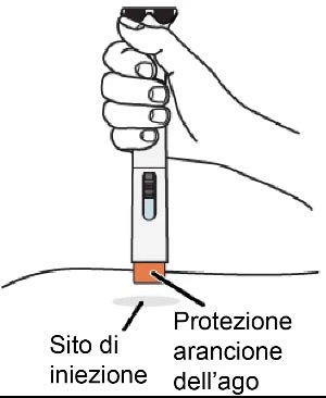 A hand holding a white medical device to inject medication into the injection site through an orange needle shield