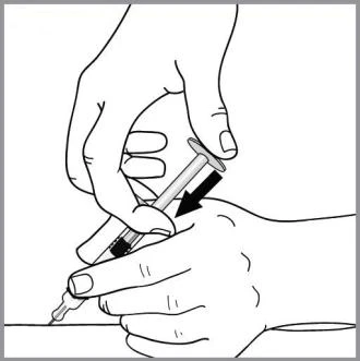 Disegno in bianco e nero di due mani che tengono una siringa per iniettare un farmaco in una superficie piana con una freccia nera verso il basso