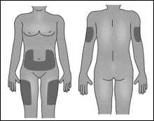 Diagramma del corpo umano che mostra aree scure applicate sull'addome, sulle cosce e sulla parte superiore delle braccia sia frontalmente che posteriormente