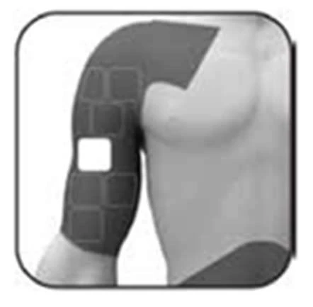Rappresentazione stilizzata di un busto maschile con un cerotto o dispositivo medico applicato sulla parte superiore del braccio e sulla spalla