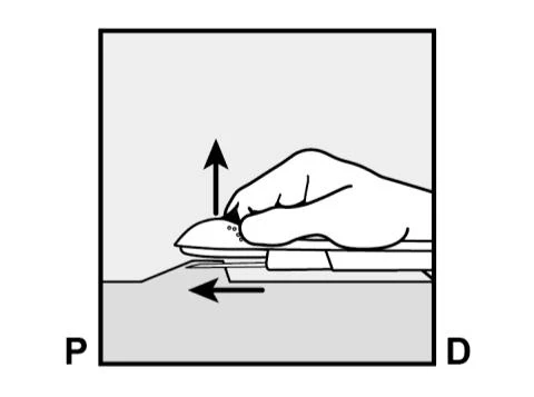 Disegno tecnico che mostra una mano che solleva un dispositivo medico verso l'alto e una freccia che indica uno scorrimento verso sinistra tra P e D