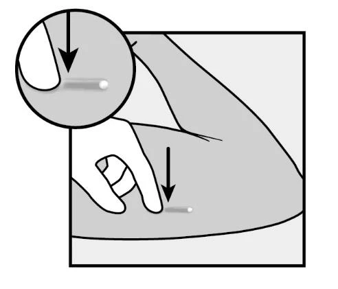 Disegno tecnico che mostra una mano che preme una penna iniettore sulla parte superiore della coscia con una freccia che indica la direzione verso il basso