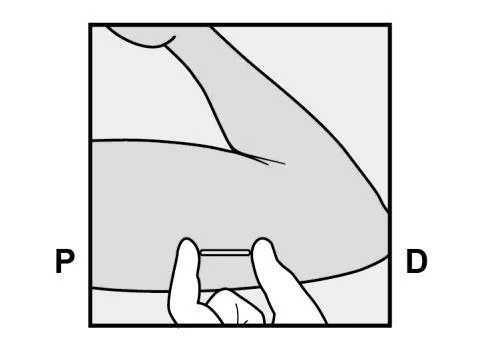 Disegno schematico di un braccio piegato con una mano che tiene una striscia sottile applicata sulla parte inferiore del braccio tra le lettere P e D