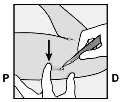 Disegno in bianco e nero che mostra una mano che tiene una siringa per iniettare un farmaco nella pelle mentre l'altra mano pizzica il tessuto
