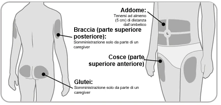 Diagramma del corpo umano che indica le zone di iniezione: braccia posteriori, glutei, addome lontano dall'ombelico e parte anteriore delle cosce