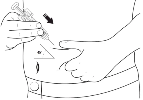 Disegno tecnico che mostra una mano che inserisce una siringa nell'addome con un angolo di 45 gradi rispetto alla pelle