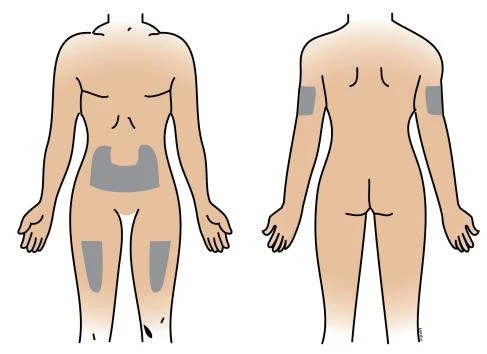 Human body diagram showing injection sites with gray areas on the abdomen, thigh, and upper arm