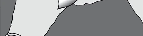 Stylized black and white drawing showing a section of a human body with a medical object penetrating the tissues