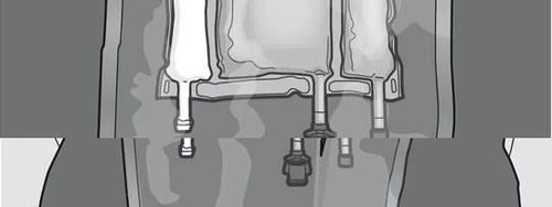 Black and white technical drawing showing three drug vials with their caps and delivery mechanisms for