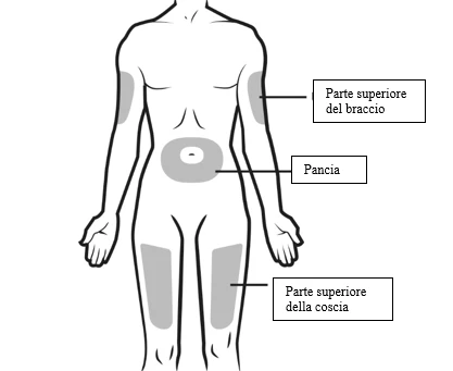 Human body diagram with shaded areas indicating upper arm, abdomen, and upper thigh