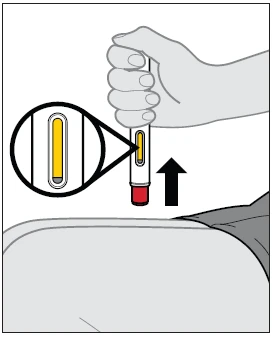 Una mano impugna un dispositivo medico cilindrico sopra un addome con una freccia nera rivolta verso l'alto e un ingrandimento del liquido giallo interno
