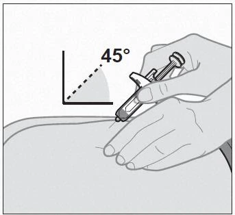 Una mano tiene una siringa inclinata a 45 gradi rispetto alla pelle per effettuare un'iniezione sottocutanea su una parte del corpo