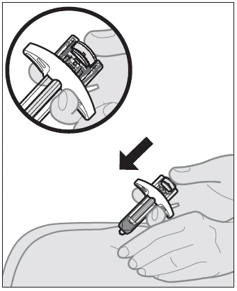 Illustrazione medica che mostra due mani che impugnano un dispositivo autoiniettore per somministrare un farmaco sulla pelle della coscia