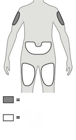 Diagramma di un corpo umano stilizzato con aree grigie sulle braccia e area bianca sulla schiena e sulle cosce con legenda in basso