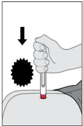 Una mano preme con forza verso il basso un dispositivo medico cilindrico bianco su una superficie corporea curva con una freccia nera rivolta verso il basso