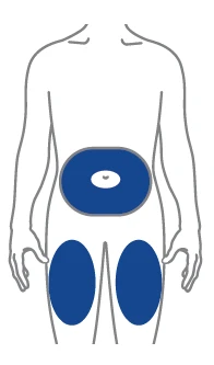Human body schematic with blue-highlighted areas on