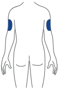 Disegno stilizzato del busto di una persona di spalle con due aree blu evidenziate sulla parte superiore di entrambe le braccia