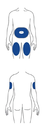 Diagram of a human body showing injection sites highlighted in blue on
