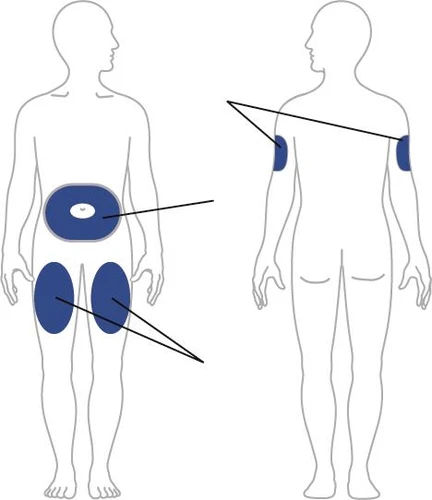 Diagram showing two human figures indicating injection sites: abdomen, upper arms, and thighs highlighted in blue