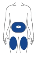Schematic of the human body with blue-highlighted areas on