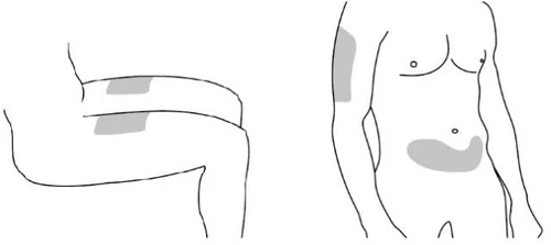 Schematic drawing of a human body showing medication application areas on the
