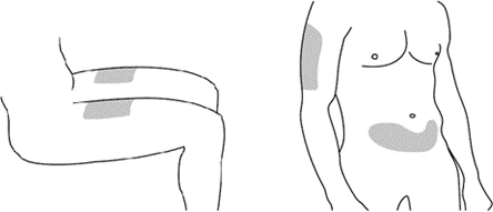 Schematic drawing of a human body highlighting injection sites on the arm, upper thigh, and