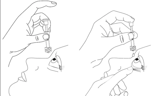 Disegno lineare che mostra due mani che applicano un flacone di farmaco vicino all'occhio di una persona per l'instillazione oculare