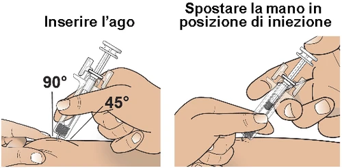 Due illustrazioni mostrano mani che impugnano una siringa per iniettare un ago a 45 gradi e poi a 90 gradi sulla pelle del braccio