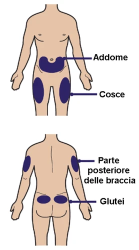 Human body diagram indicating injection sites: abdomen, thighs, back of the arms, and buttocks