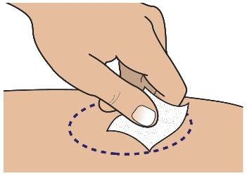 A hand applying a white adhesive bandage to a skin area outlined by a dashed dark blue circle