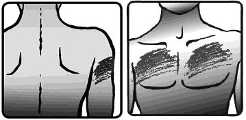 Two schematic drawings show the torso of a man with highlighted areas on the upper back and chest indicating application sites