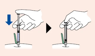 Diagram showing two hands holding a syringe injecting liquid into a white surface, with a blue arrow pointing downward