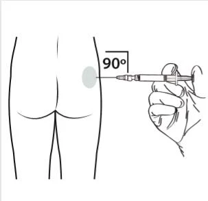 Disegno schematico di una mano che impugna una siringa per iniettare un farmaco nel gluteo con un angolo di 90 gradi rispetto alla pelle