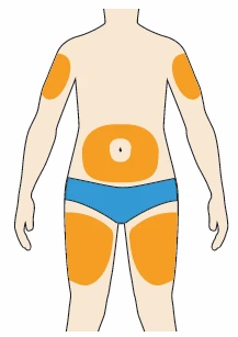 Human body diagram with orange highlighted areas on arms, on