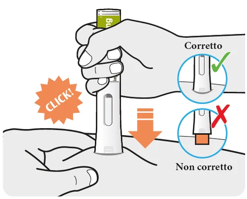 Medical illustration showing the