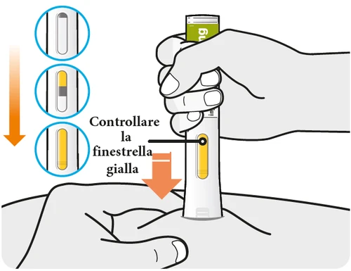 Medical illustration showing a hand holding an autoinjector above the skin and three circles with magnifications to check the yellow viewing window
