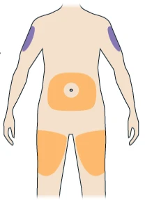 Human body diagram with purple areas on arms and orange on