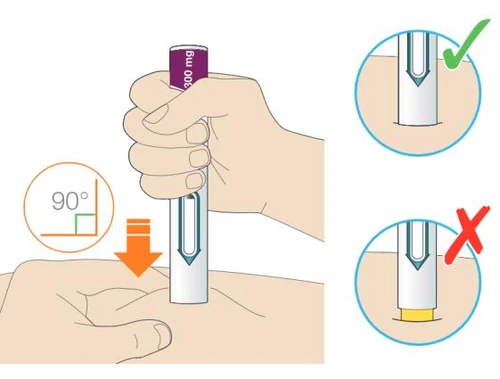 Medical illustration showing the