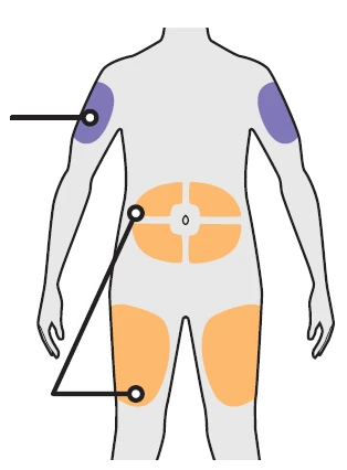 Human body diagram with purple areas on arms and orange on