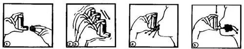 Sequence of four illustrations showing how to insert a medical device into the nose by pressing in and then removing it with an outward motion