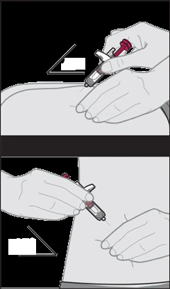 Medical illustration showing two methods of injecting a drug using a pre-filled syringe into the skin of the