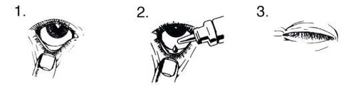 Three sequential drawings show the
