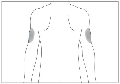 Esquema lineal del torso y los brazos de un hombre visto desde atrás con dos áreas grises que indican los puntos de inyección en los brazos