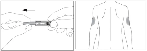 Dos manos sostienen una jeringa con una flecha que indica el movimiento y un diagrama del torso con zonas grises en los brazos