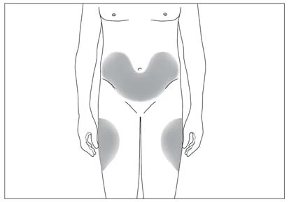Esquema del cuerpo humano con áreas grises que indican zonas de aplicación en