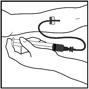 Una mano tiene una penna iniettore collegata tramite un tubicino sottile a un dispositivo applicato sulla pelle di una gamba o un braccio