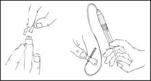 Disegno tecnico che mostra due mani che rimuovono il cappuccio protettivo da un dispositivo medico e una mano che impugna lo strumento con un cavo