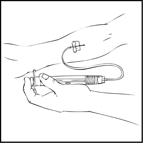 Disegno lineare di una mano che impugna un dispositivo medico collegato tramite un tubicino a un applicatore applicato sul braccio