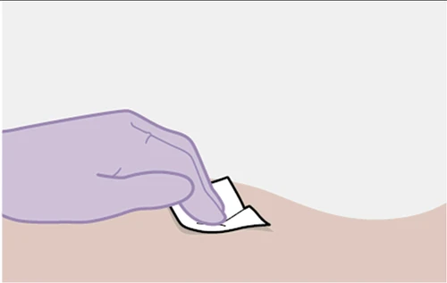 Una mano guantata di colore viola solleva delicatamente un piccolo cerotto bianco applicato sulla pelle di un braccio o di una gamba